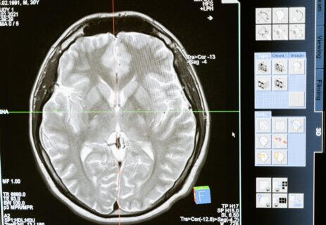 How Science Supports Microdosing